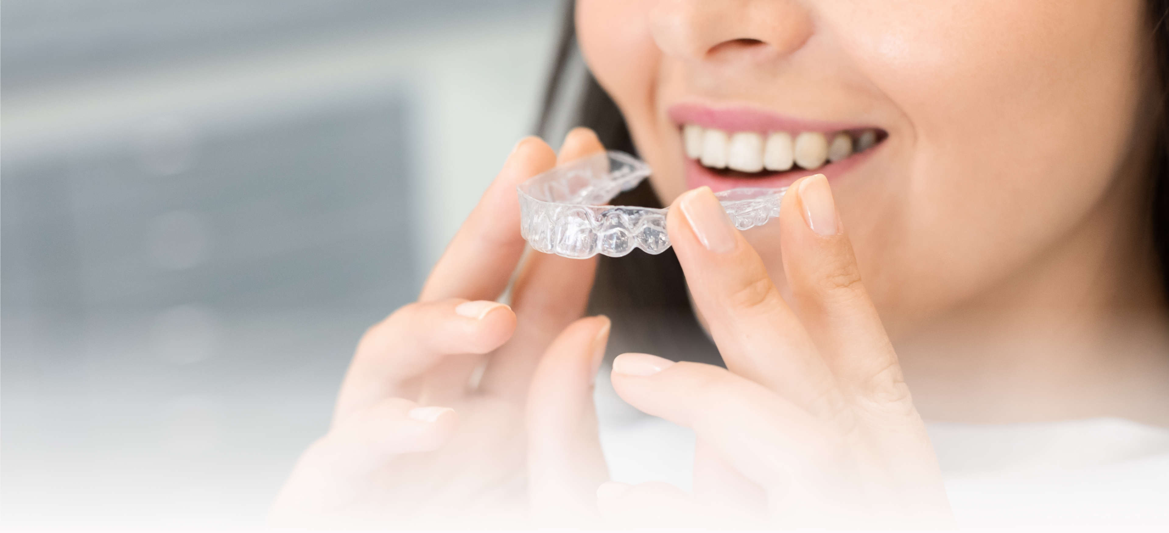 Traitement par aligneurs transparents